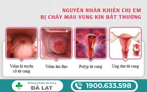 Hình ảnh minh họa